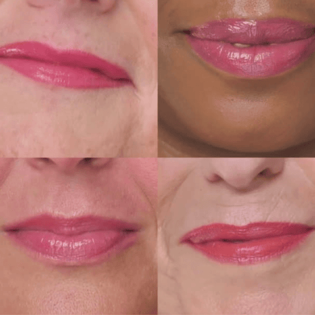 Fuller more hydrated lips in two weeks